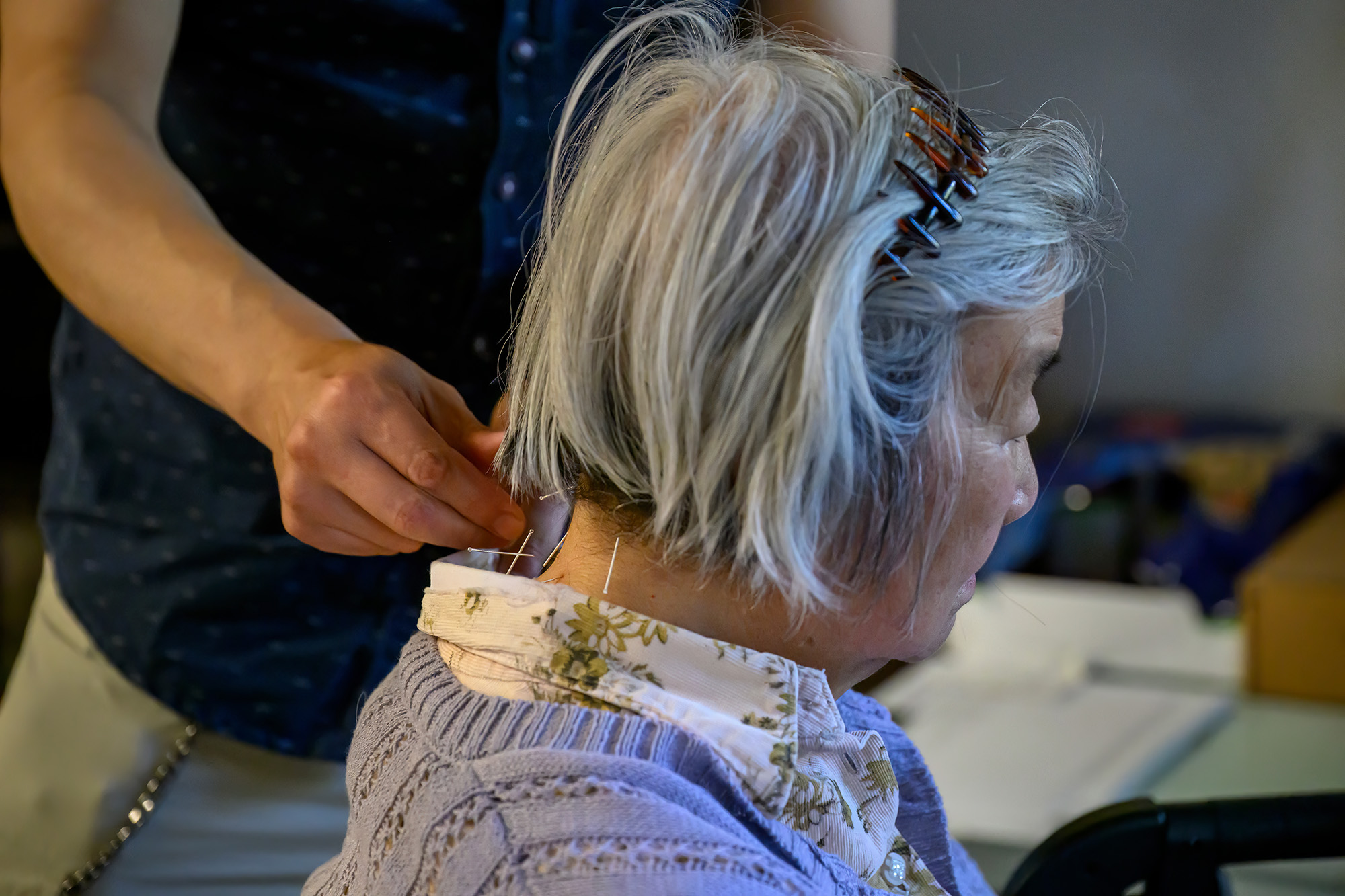 An elderly woman being treated with acupuncture.
